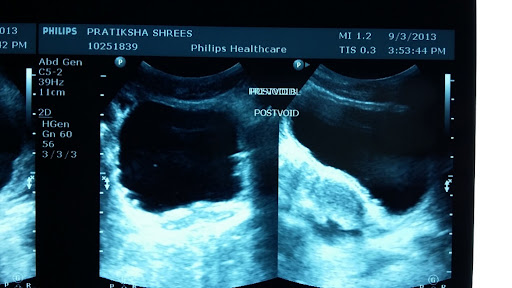 USG DMSA renal scan